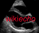 Wikiecho.png